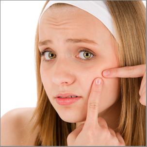 Acne facial care teenager woman squeezing pimple